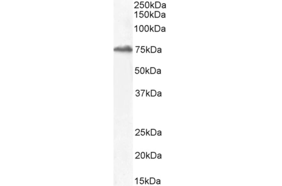 Western Blot - Anti-HIC1 Antibody (A82826) - Antibodies.com