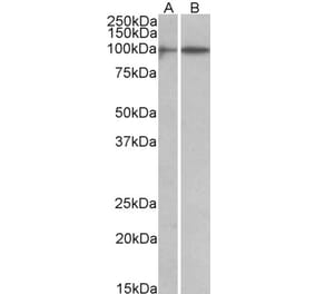 Western Blot - Anti-HIC1 Antibody (A82826) - Antibodies.com