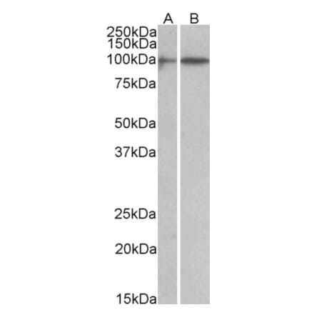 Western Blot - Anti-HIC1 Antibody (A82826) - Antibodies.com