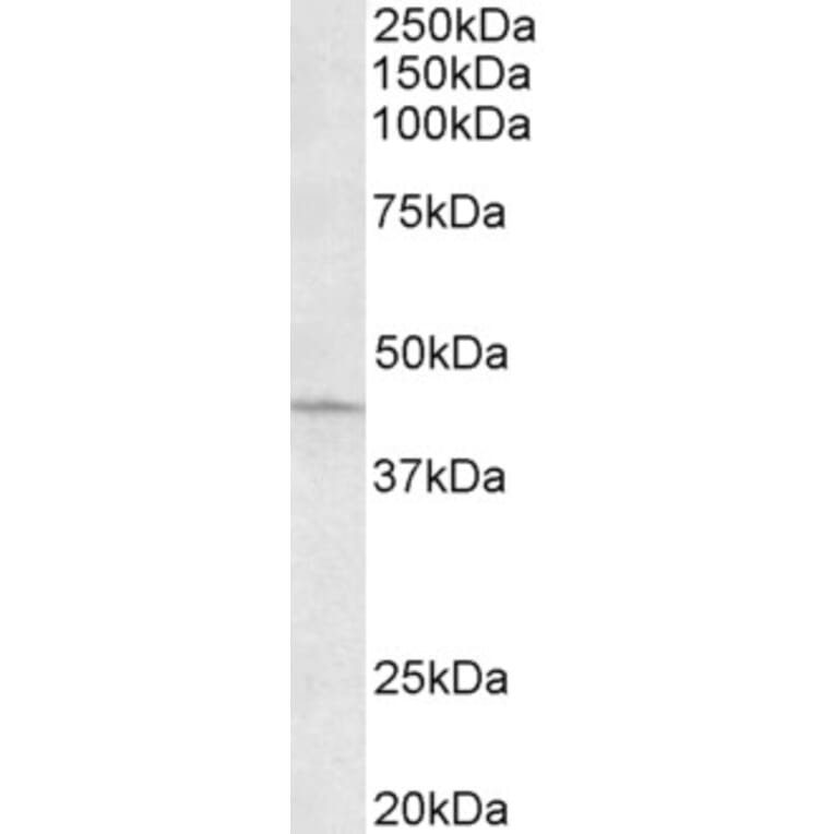 Western Blot - Anti-ARPC1A Antibody (A82827) - Antibodies.com