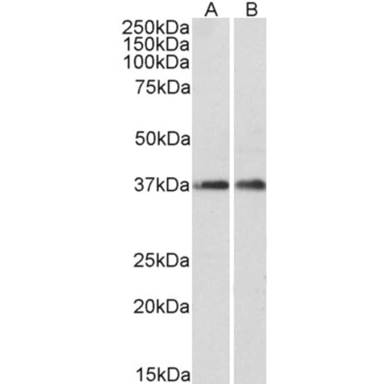 Western Blot - Anti-ARPC1A Antibody (A82827) - Antibodies.com