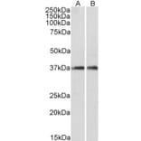 Western Blot - Anti-ARPC1A Antibody (A82827) - Antibodies.com