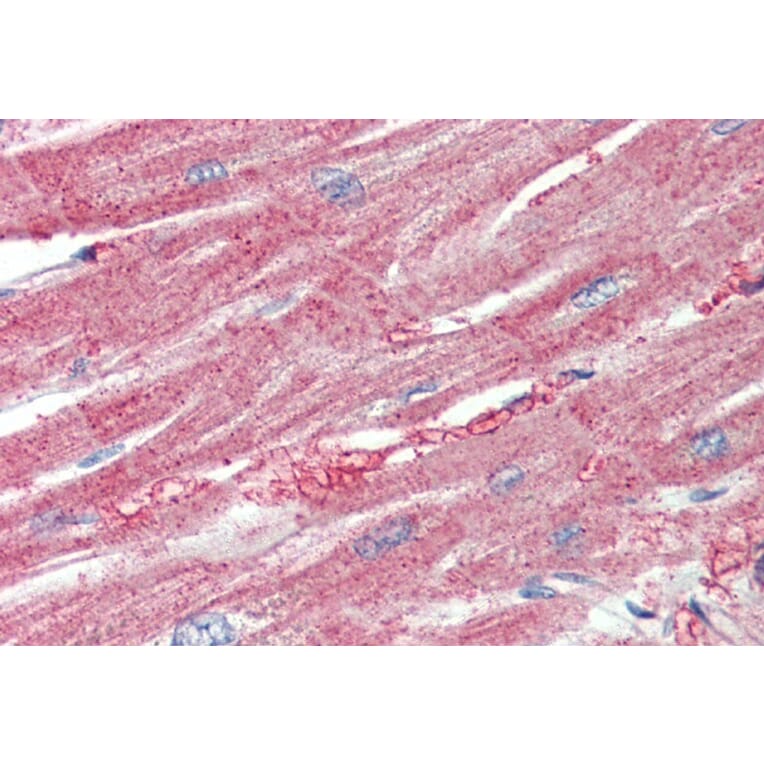Immunohistochemistry - Anti-ARPC1A Antibody (A82827) - Antibodies.com