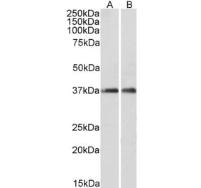 Western Blot - Anti-ARPC1A Antibody (A82827) - Antibodies.com