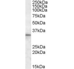 Western Blot - Anti-HAX1 Antibody (A82828) - Antibodies.com