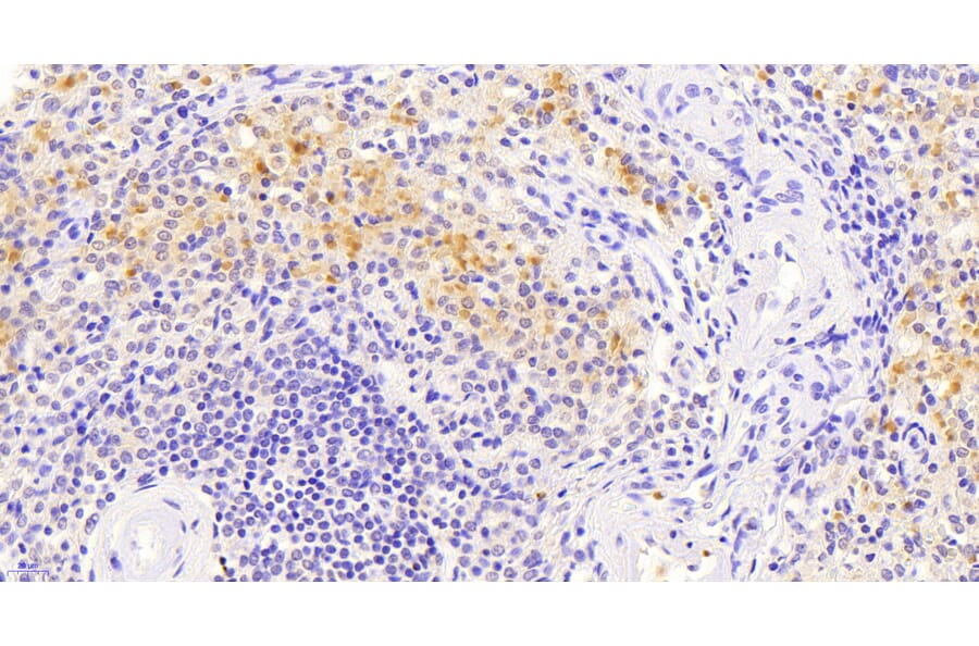 Immunohistochemistry - Anti-VAV3 Antibody (A82829) - Antibodies.com
