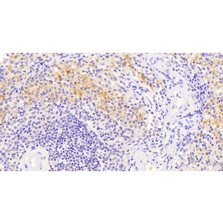 Immunohistochemistry - Anti-VAV3 Antibody (A82829) - Antibodies.com