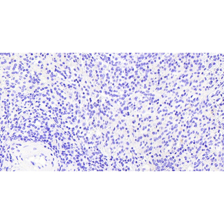 Immunohistochemistry - Anti-VAV3 Antibody (A82829) - Antibodies.com