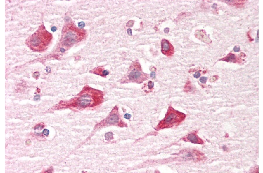 Immunohistochemistry - Anti-Caprin-1 Antibody (A82831) - Antibodies.com