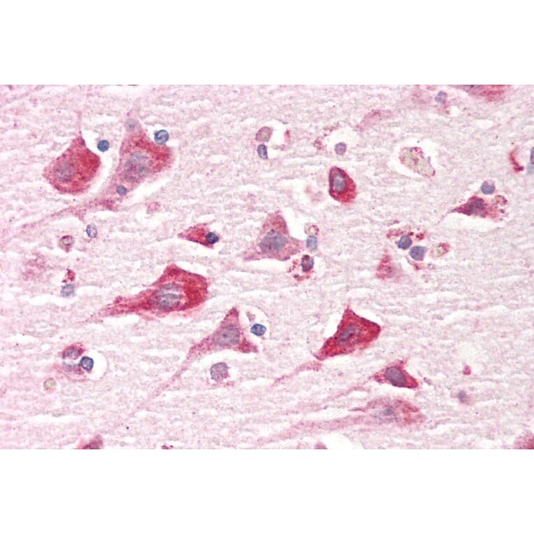Immunohistochemistry - Anti-Caprin-1 Antibody (A82831) - Antibodies.com
