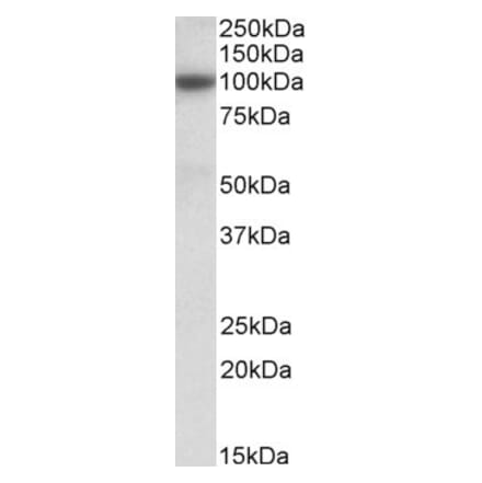 Western Blot - Anti-MRP4 Antibody (A82832) - Antibodies.com