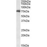 Western Blot - Anti-USH1C Antibody (A82836) - Antibodies.com