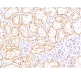 Immunohistochemistry - Anti-MRP5 Antibody (A82837) - Antibodies.com