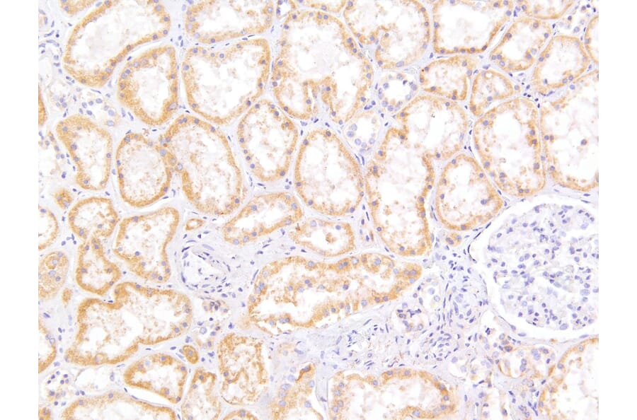 Immunohistochemistry - Anti-MRP5 Antibody (A82837) - Antibodies.com