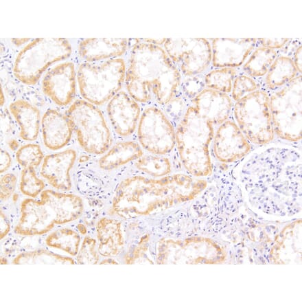 Immunohistochemistry - Anti-MRP5 Antibody (A82837) - Antibodies.com