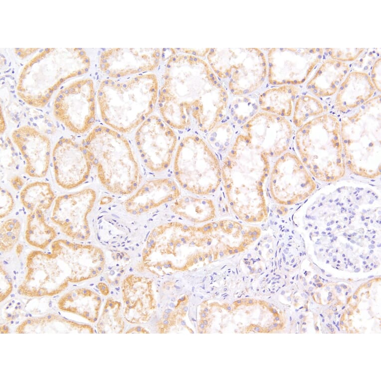 Immunohistochemistry - Anti-MRP5 Antibody (A82837) - Antibodies.com