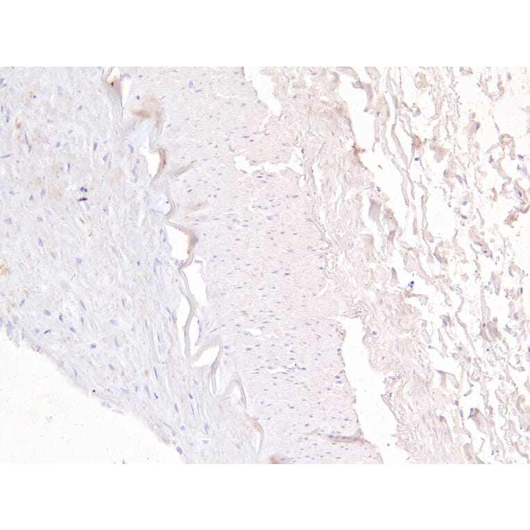 Immunohistochemistry - Anti-MRP5 Antibody (A82837) - Antibodies.com