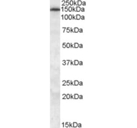 Western Blot - Anti-ABCC5 Antibody (A82837) - Antibodies.com