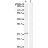 Western Blot - Anti-Kallikrein 2/KLK2 Antibody (A82839) - Antibodies.com