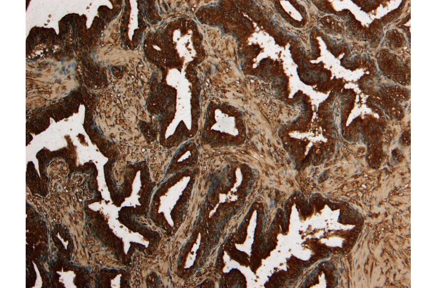 Immunohistochemistry - Anti-Kallikrein 2/KLK2 Antibody (A82839) - Antibodies.com
