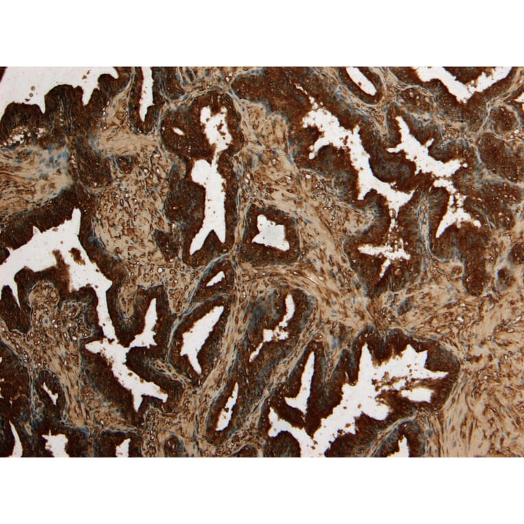 Immunohistochemistry - Anti-Kallikrein 2/KLK2 Antibody (A82839) - Antibodies.com