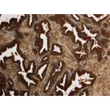 Immunohistochemistry - Anti-Kallikrein 2/KLK2 Antibody (A82839) - Antibodies.com