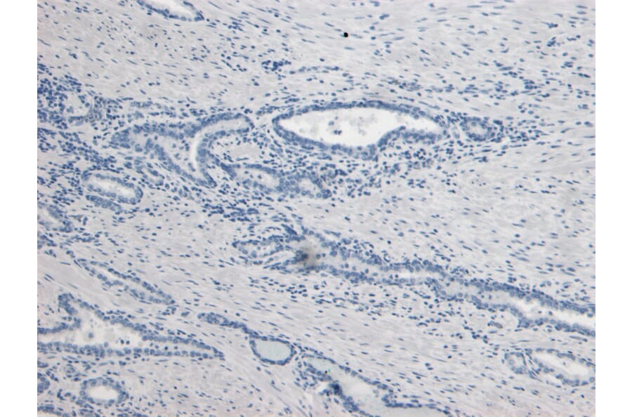 Immunohistochemistry - Anti-Kallikrein 2/KLK2 Antibody (A82839) - Antibodies.com