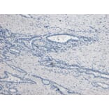 Immunohistochemistry - Anti-Kallikrein 2/KLK2 Antibody (A82839) - Antibodies.com
