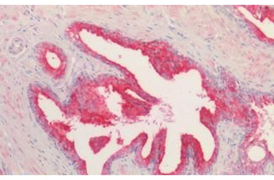 Immunohistochemistry - Anti-Kallikrein 2/KLK2 Antibody (A82839) - Antibodies.com
