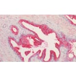 Immunohistochemistry - Anti-Kallikrein 2/KLK2 Antibody (A82839) - Antibodies.com
