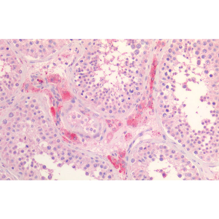 Immunohistochemistry - Anti-Scavenging Receptor SR-BI Antibody (A82840) - Antibodies.com