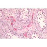 Immunohistochemistry - Anti-Scavenging Receptor SR-BI Antibody (A82840) - Antibodies.com