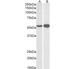 Western Blot - Anti-GLUD1 Antibody (A82841) - Antibodies.com