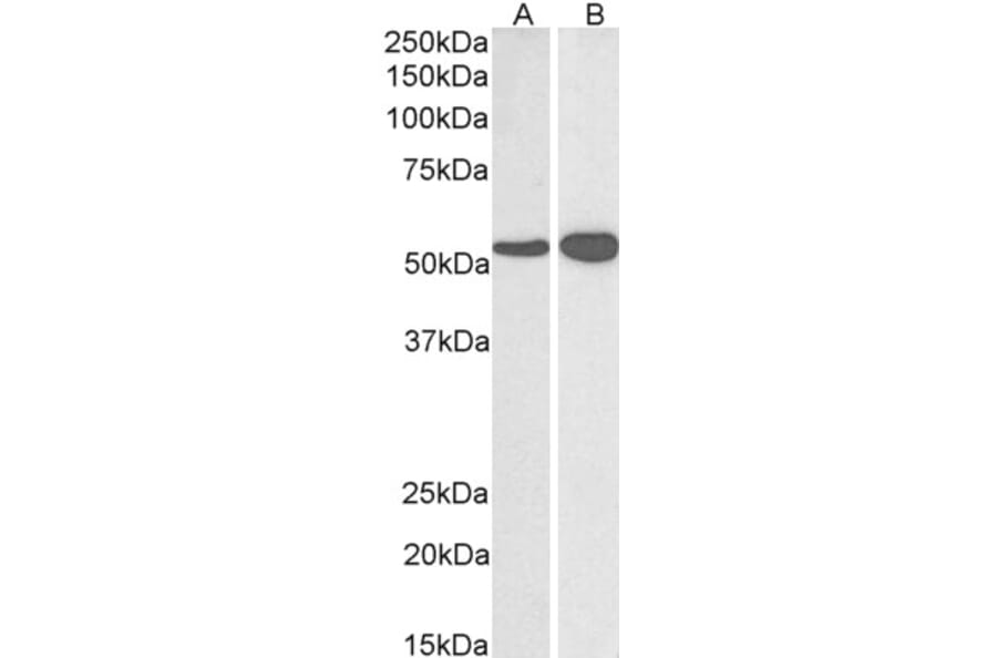 Western Blot - Anti-GLUD1 Antibody (A82841) - Antibodies.com