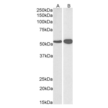 Western Blot - Anti-GLUD1 Antibody (A82841) - Antibodies.com