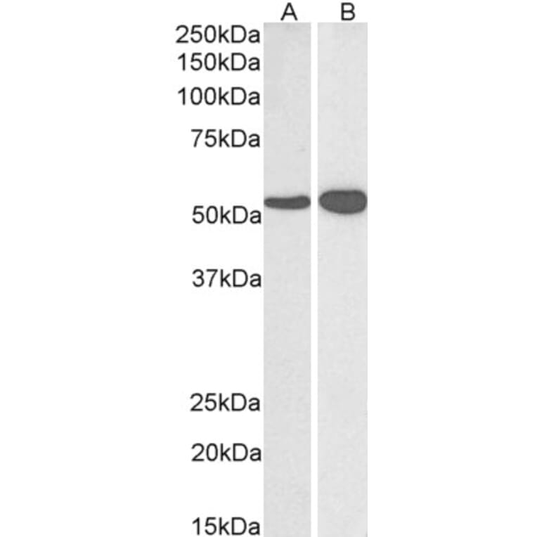 Western Blot - Anti-GLUD1 Antibody (A82841) - Antibodies.com