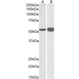 Western Blot - Anti-GLUD1 Antibody (A82841) - Antibodies.com