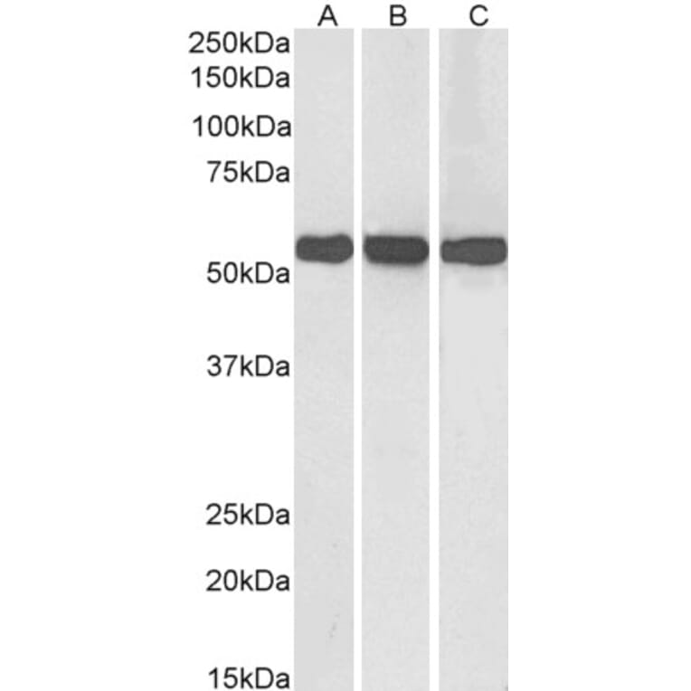 Western Blot - Anti-GLUD1 Antibody (A82841) - Antibodies.com