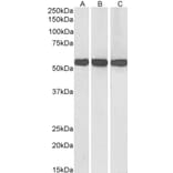 Western Blot - Anti-GLUD1 Antibody (A82841) - Antibodies.com