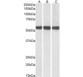Western Blot - Anti-GLUD1 / GLUD2 Antibody (A82841) - Antibodies.com
