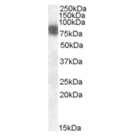 Western Blot - Anti-Cortactin Antibody (A82842) - Antibodies.com