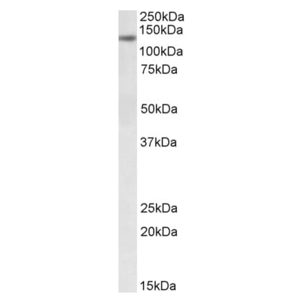 Western Blot - Anti-DIAPH1 Antibody (A82843) - Antibodies.com