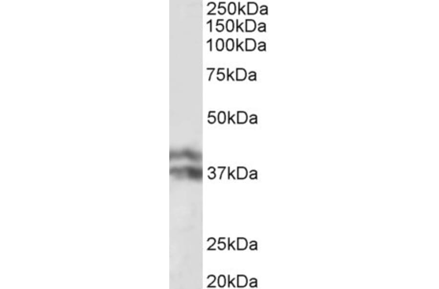Western Blot - Anti-Haptoglobin beta Chain Antibody (A82845) - Antibodies.com