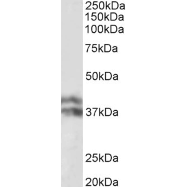 Western Blot - Anti-Haptoglobin beta Chain Antibody (A82845) - Antibodies.com