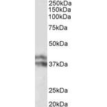 Western Blot - Anti-Haptoglobin beta Chain Antibody (A82845) - Antibodies.com