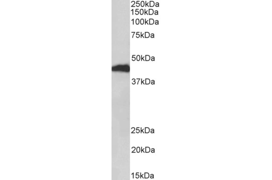 Western Blot - Anti-Haptoglobin beta Chain Antibody (A82845) - Antibodies.com