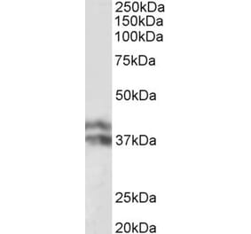 Western Blot - Anti-HP Antibody (A82845) - Antibodies.com