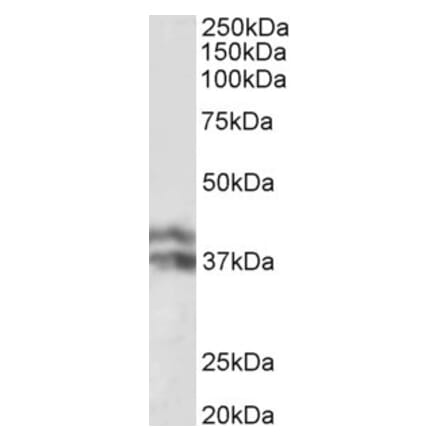 Western Blot - Anti-HP Antibody (A82845) - Antibodies.com