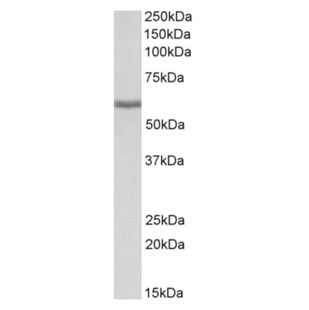 Western Blot - Anti-Fibrinogen beta Chain Antibody (A82847) - Antibodies.com