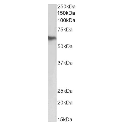 Western Blot - Anti-Fibrinogen beta Chain Antibody (A82848) - Antibodies.com